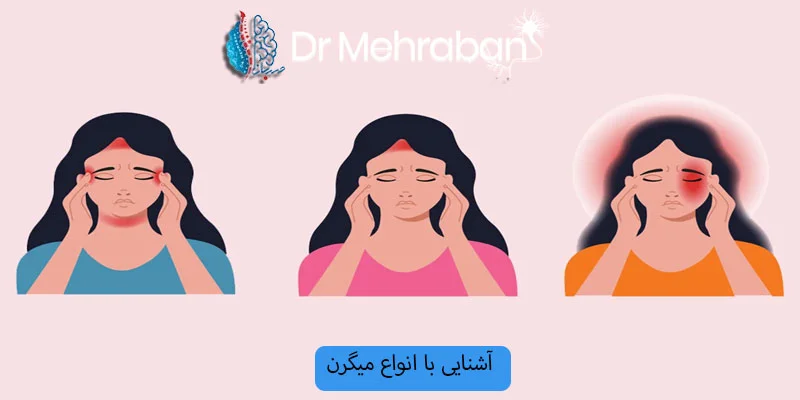 انواع-میگرن