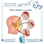 نورالژی عصب سه قلو
