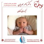 میکروسفالی در کودکان