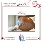 هیدروسفالی در کودکان