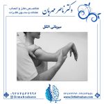 میوپاتی-مزمن-الکل