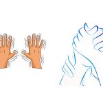 اختلالات-حرکتی