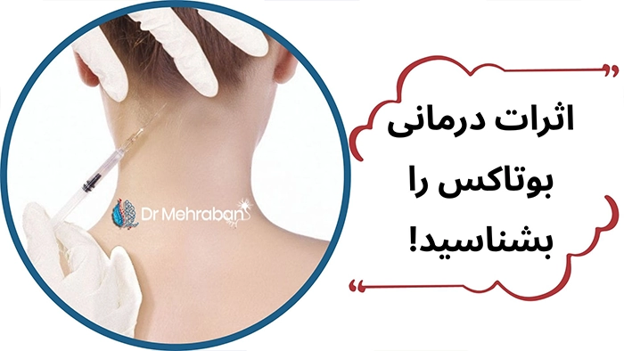 بوتاکس درمانی