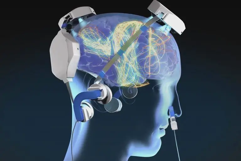 درمان پارکینسون با RTMS