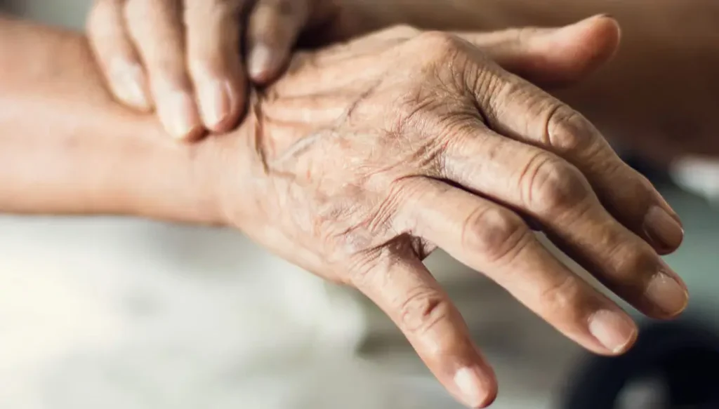 درمان پارکینسون با آر تی ام اس