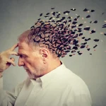 درمان آلزایمر با آر تی ام اس