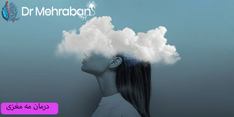 درمان مه مغزی