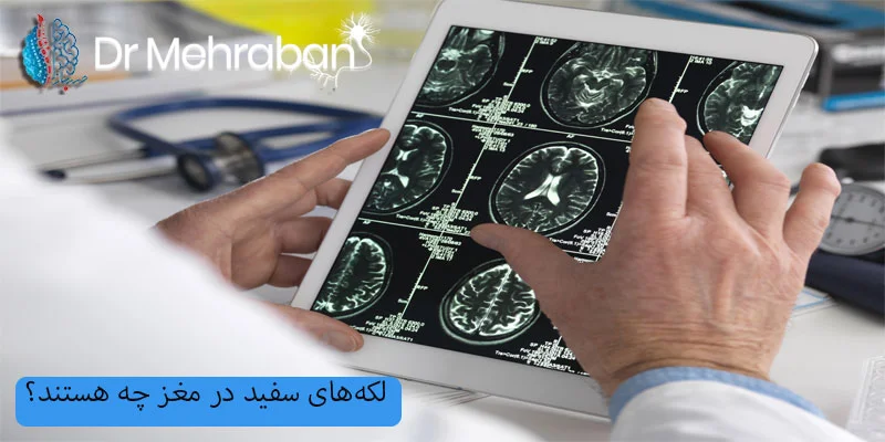 لکه_های-سفید-در-مغز-چه-هستند؟