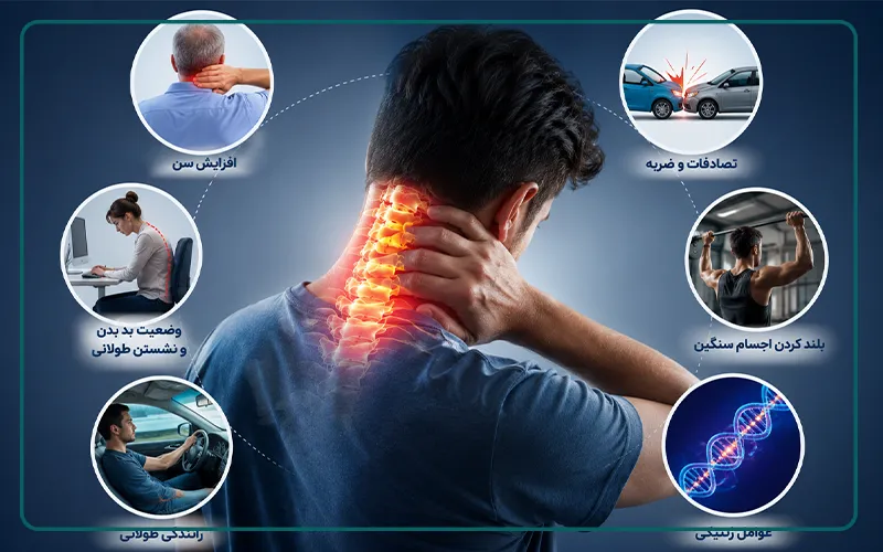 علت آرتروز گردن